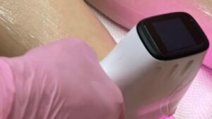 Cicatrização pós procedimento estético, como cuidar e quais produtos usar