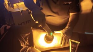 Fotobiomodulação: quando a luz deixa de ser acessório e se torna estratégia terapêutica