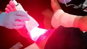 Por que vemos tanta luz vermelha nos protocolos de fotobiomodulação?
